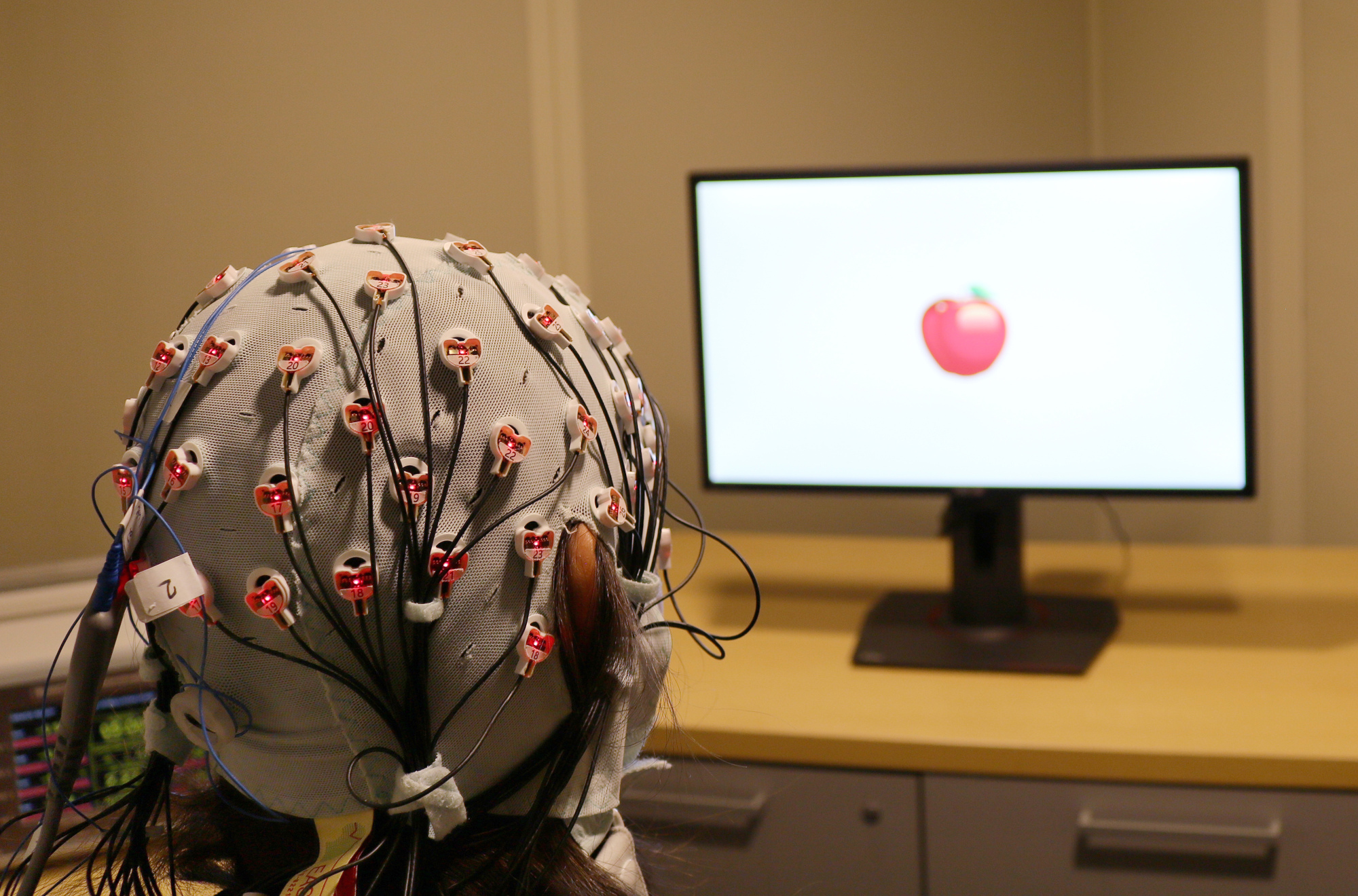 Zap cap: Electrical brain stimulation seen boosting memory
